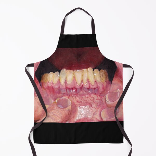 Item preview, Gums designed and sold by Zombiefatal88.