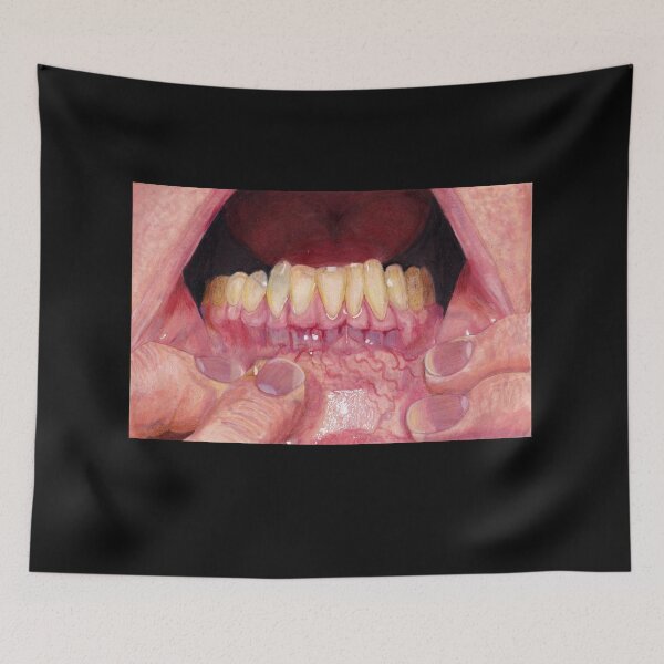Item preview, Gums designed and sold by Zombiefatal88.
