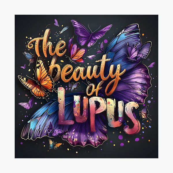 Aperçu de l'œuvre Beauté du lupus 2 créée et vendue par wayneflint.