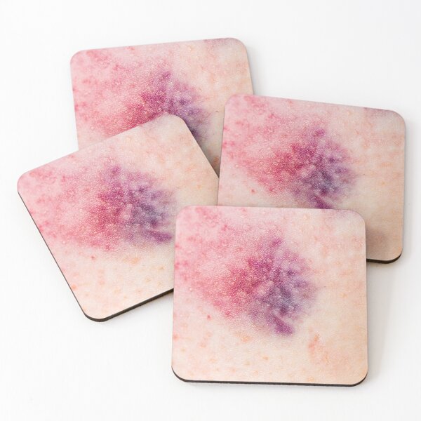 Item preview, Bruises made in Berlin (Blanc) designed and sold by Swen Brandy.
