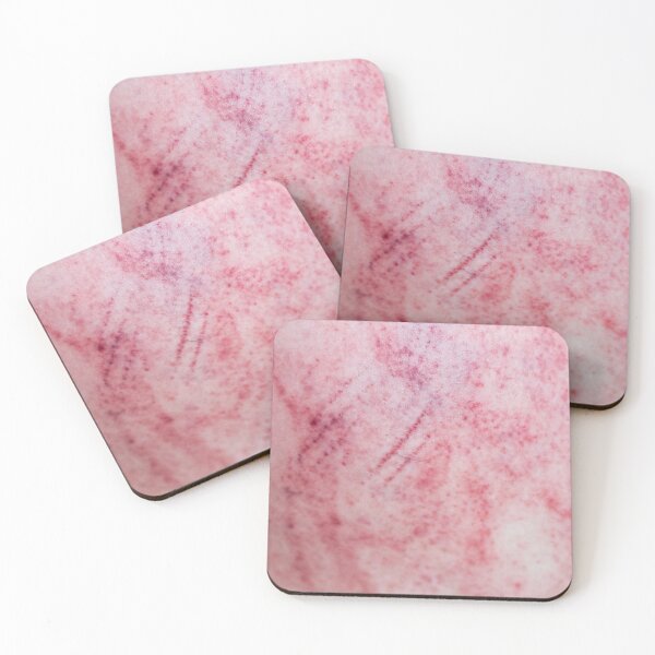 Item preview, Bruises Stripe Vol. 2 designed and sold by Swen Brandy.