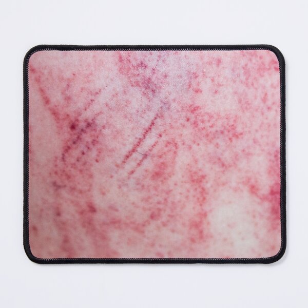Item preview, Bruises Stripe Vol. 2 designed and sold by Swen Brandy.