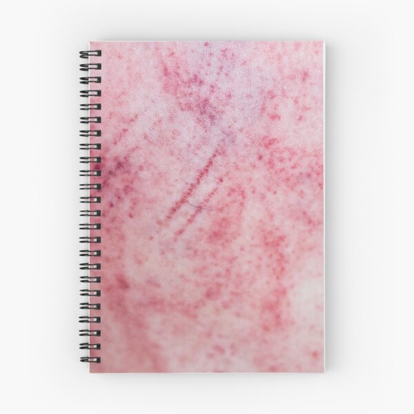 Item preview, Bruises Stripe Vol. 2 designed and sold by Swen Brandy.