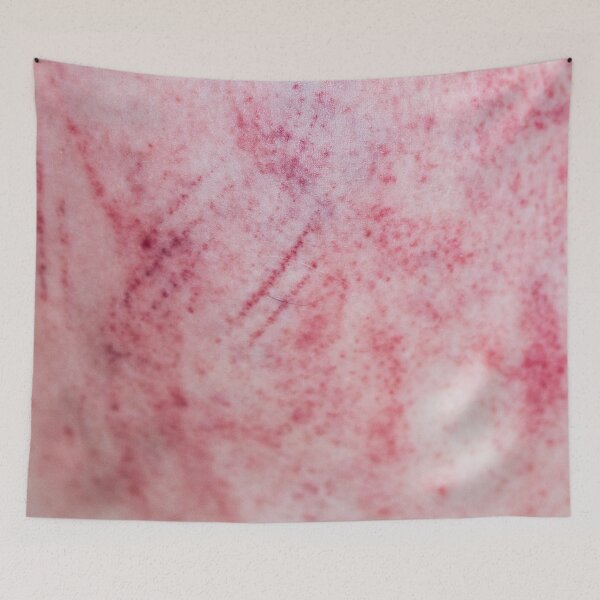 Item preview, Bruises Stripe Vol. 2 designed and sold by Swen Brandy.