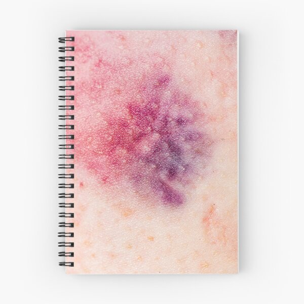 Item preview, Bruises made in Berlin (Blanc) designed and sold by Swen Brandy.