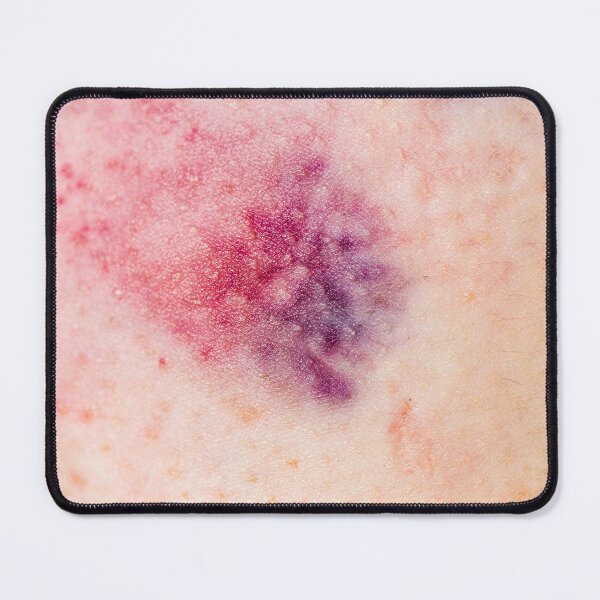 Item preview, Bruises made in Berlin (Blanc) designed and sold by Swen Brandy.