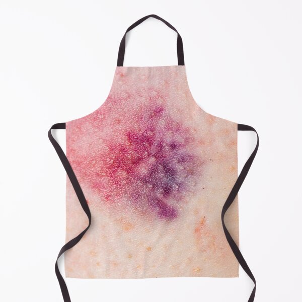 Item preview, Bruises made in Berlin (Blanc) designed and sold by Swen Brandy.