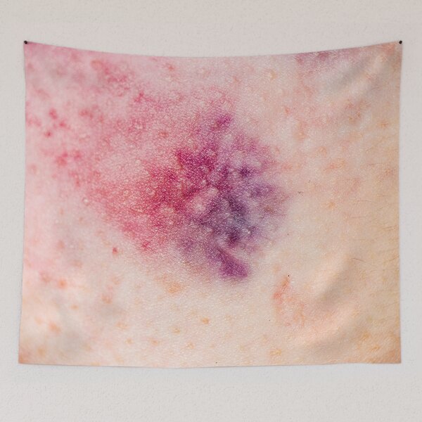 Item preview, Bruises made in Berlin (Blanc) designed and sold by Swen Brandy.