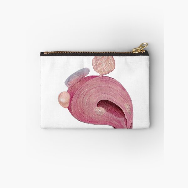 Item preview, Uterine Fibroids designed and sold by cre8tive-liv.
