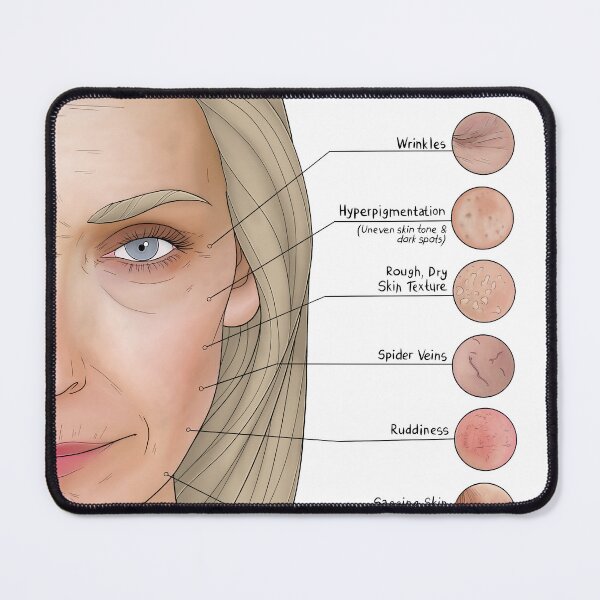 Item preview, Aging designed and sold by TIBOM.