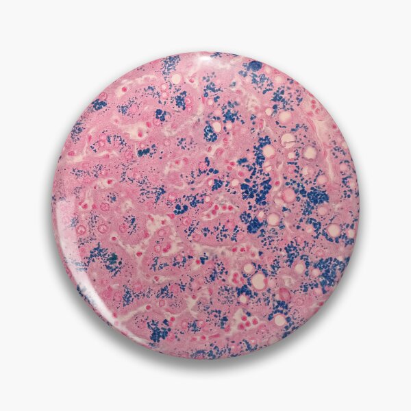 Item preview, Perl’s stain (liver biopsy) designed and sold by CellPathWorld.