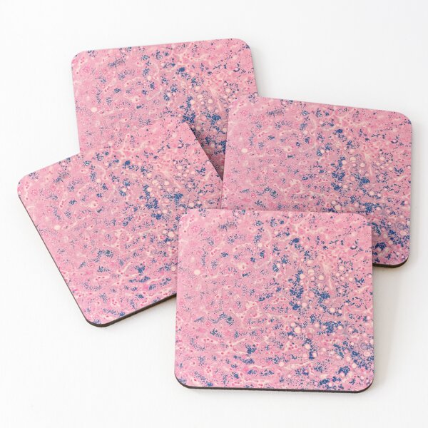 Item preview, Perl’s stain (liver biopsy) designed and sold by CellPathWorld.