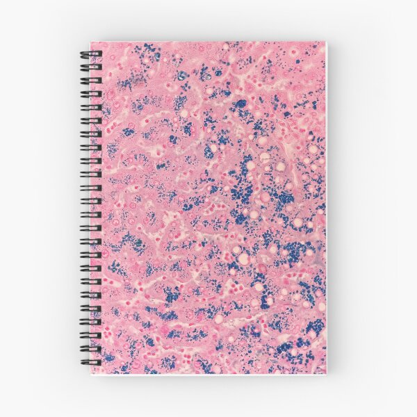 Item preview, Perl’s stain (liver biopsy) designed and sold by CellPathWorld.