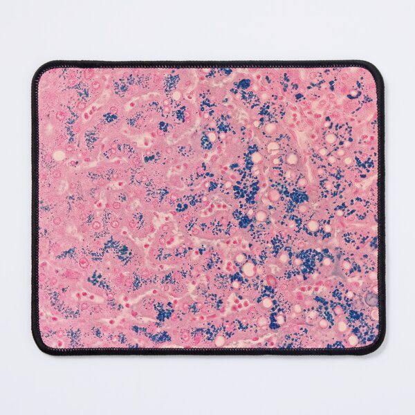 Item preview, Perl’s stain (liver biopsy) designed and sold by CellPathWorld.