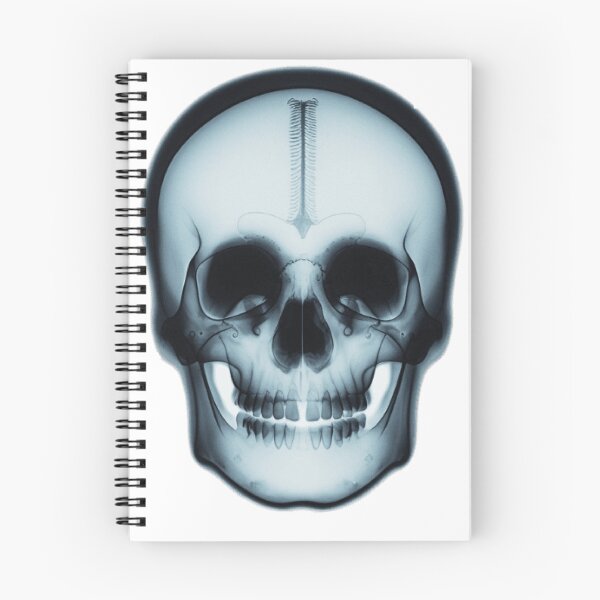 Item preview, X Ray Skull designed and sold by WAISLYV.