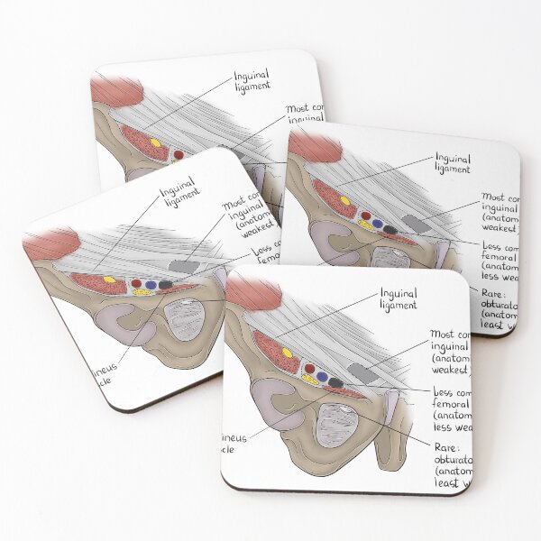 Item preview, Obturator Canal designed and sold by TIBOM.