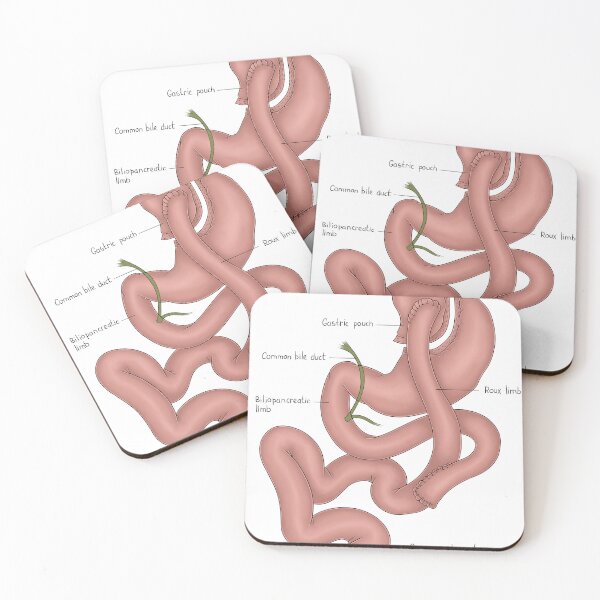 Item preview, Bariatric Surgery designed and sold by TIBOM.