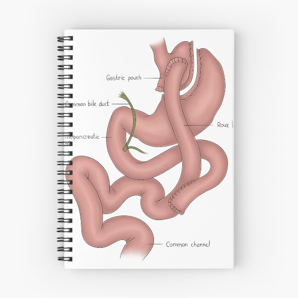Item preview, Bariatric Surgery designed and sold by TIBOM.