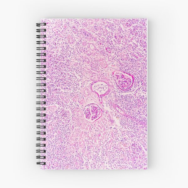 Item preview, PAS stain kidney  designed and sold by CellPathWorld.