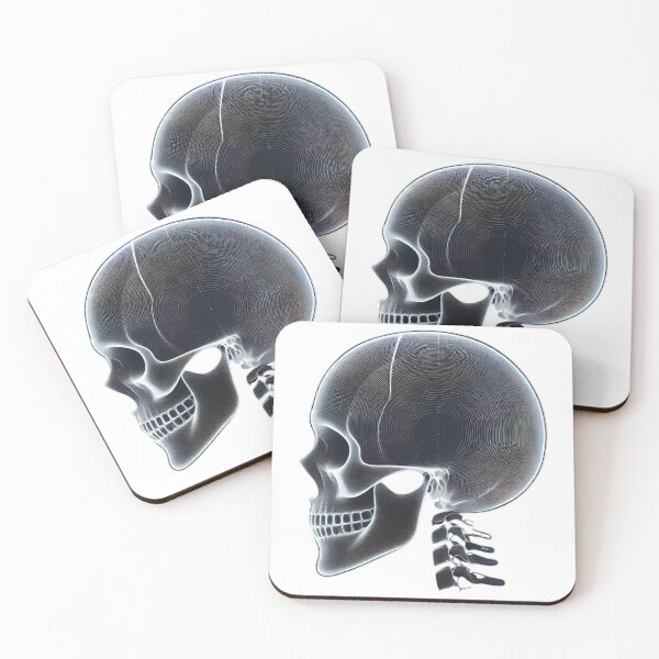 Item preview, Human Skull X-ray designed and sold by Blink Art Studio.