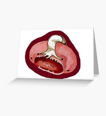 Screaming for Nature Greeting Card