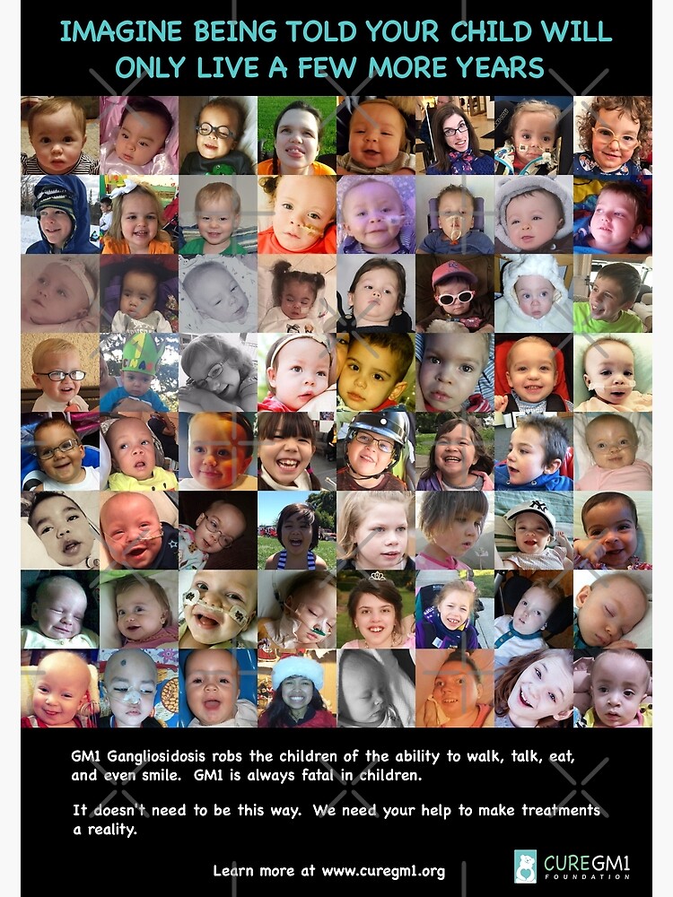 Thumbnail 3 of 3, Poster, GM1 Gangliosidosis Poster designed and sold by arrtworks.