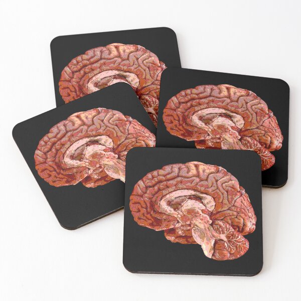 Item preview, Brain designed and sold by Wyyrmwood.