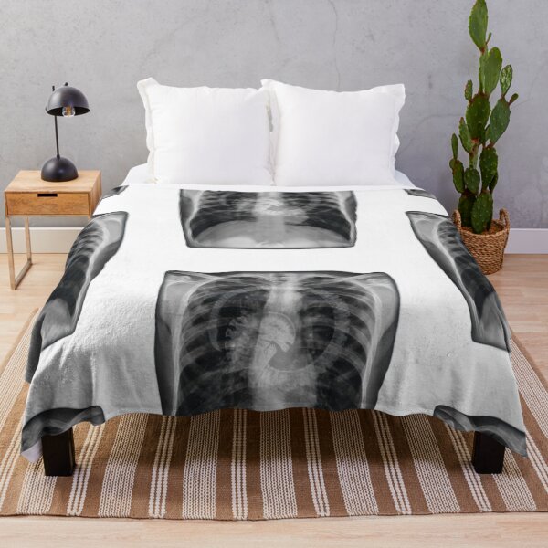 Item preview, Alien Chest X Ray designed and sold by mattlillis13.