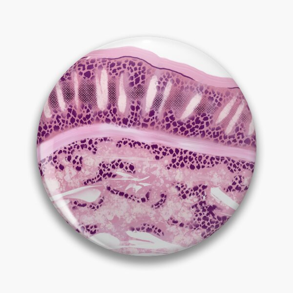 Item preview, Larynx Epithelium designed and sold by Spilled--Ink.