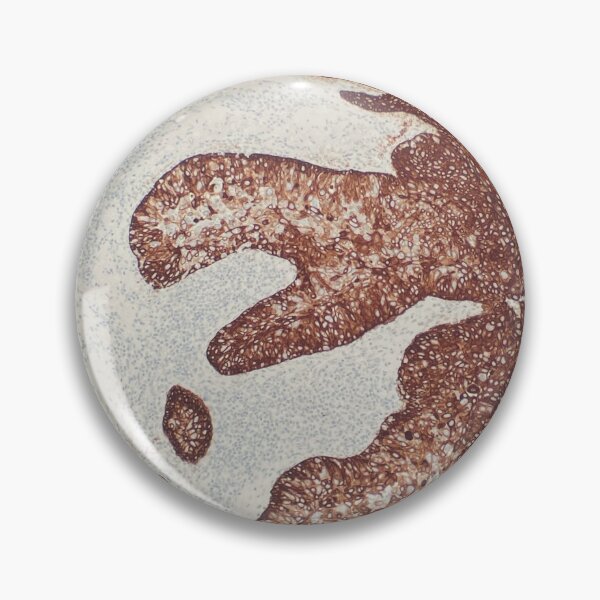 Item preview, Immunohistochemistry CK20 designed and sold by CellPathWorld.