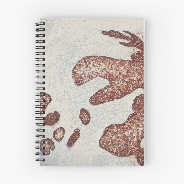 Item preview, Immunohistochemistry CK20 designed and sold by CellPathWorld.