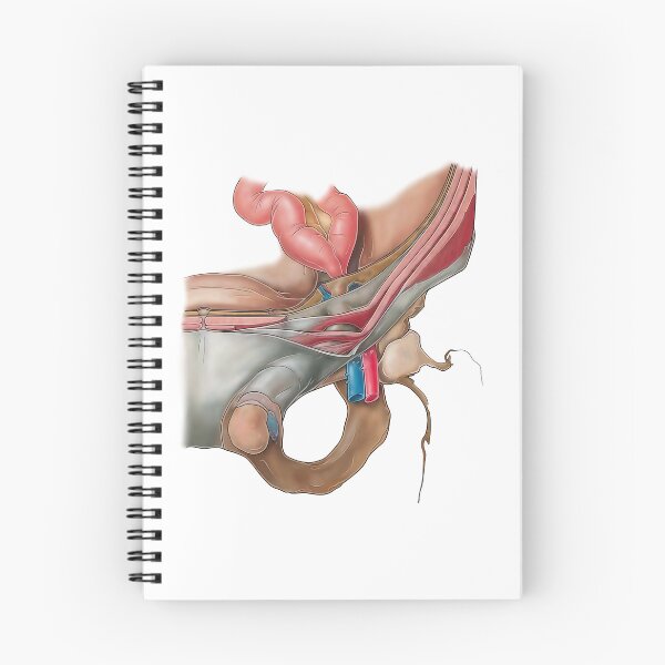 Item preview, Hernia Anatomy designed and sold by TIBOM.