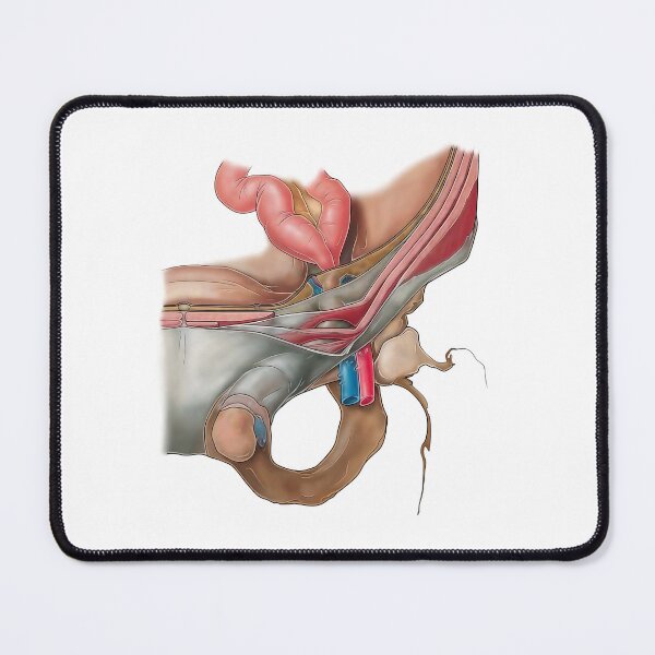 Item preview, Hernia Anatomy designed and sold by TIBOM.