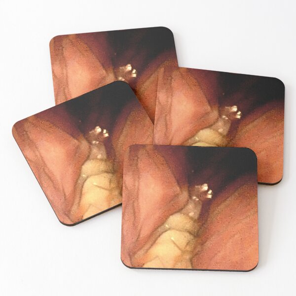 Item preview, Molars designed and sold by ontological.
