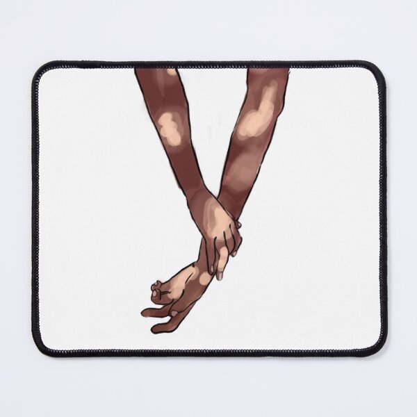 Item preview, Vitiligo designed and sold by Theoschronicles.