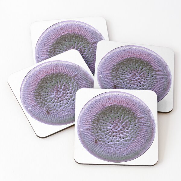 Item preview, Diatom - Lindavia radiosa (SEM) designed and sold by DiatomsATTACK.