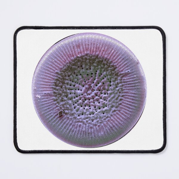 Item preview, Diatom - Lindavia radiosa (SEM) designed and sold by DiatomsATTACK.