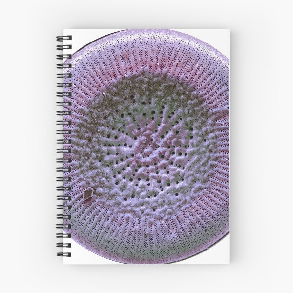 Item preview, Diatom - Lindavia radiosa (SEM) designed and sold by DiatomsATTACK.