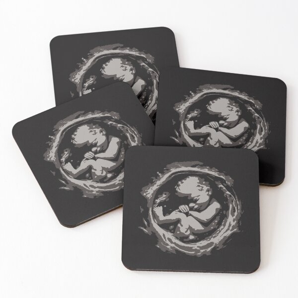Item preview, Ultrasound baby scan silhouette on dark background designed and sold by BellaRoxiell.