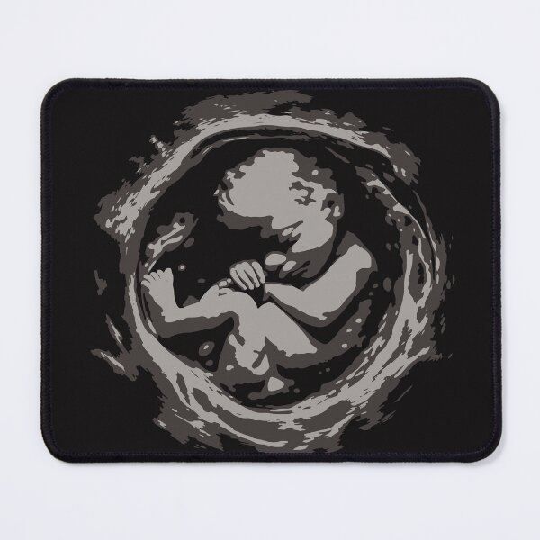 Item preview, Ultrasound baby scan silhouette on dark background designed and sold by BellaRoxiell.