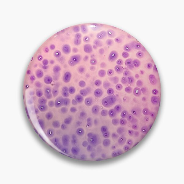 Item preview, Giemsa - bone marrow trephine biopsy designed and sold by CellPathWorld.