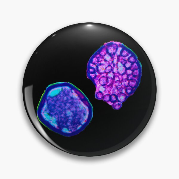 Item preview, Coccidioides endospores filled with spherules designed and sold by Creative Endeavors ..