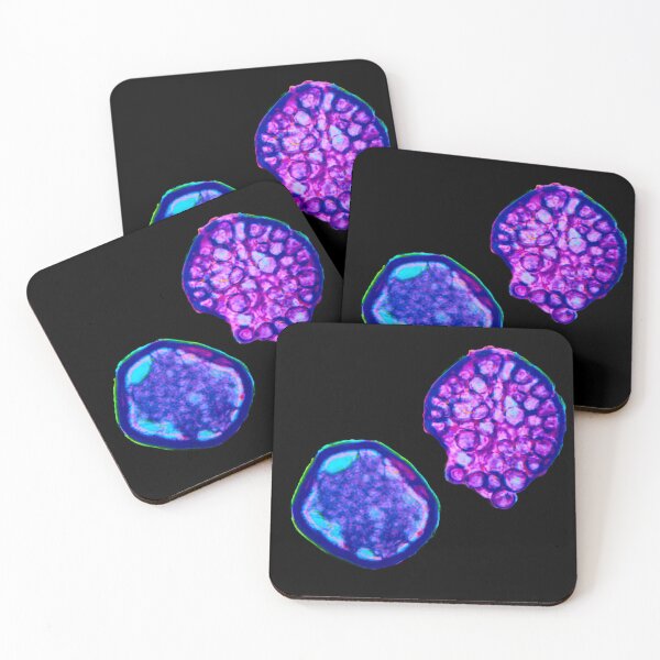 Item preview, Coccidioides endospores filled with spherules designed and sold by Creative Endeavors ..