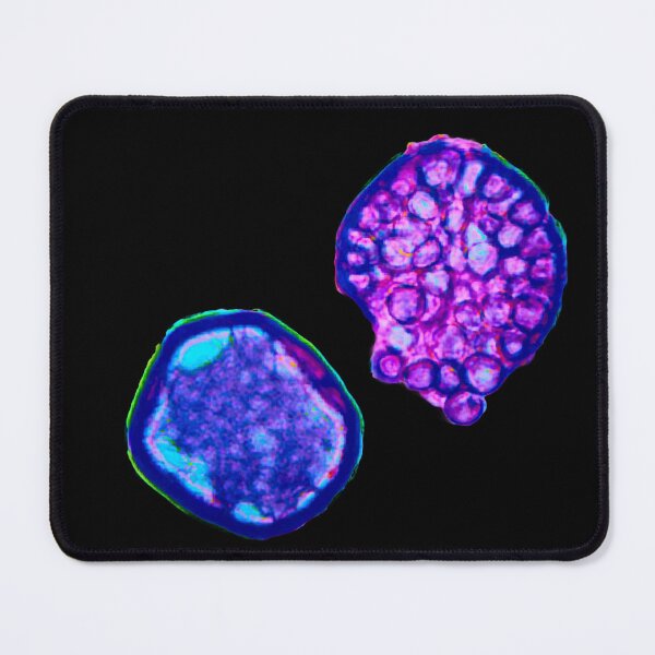 Item preview, Coccidioides endospores filled with spherules designed and sold by Creative Endeavors ..