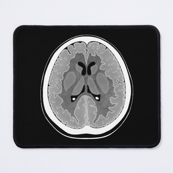 Item preview, CT Brain Scan Illustration - Neuroscience designed and sold by BundaBear.