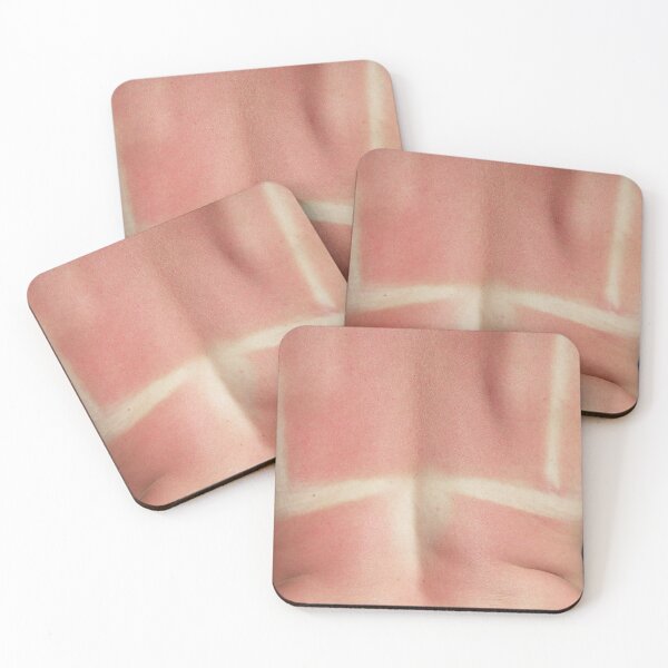 Item preview, Human back burnt after sunburn. Scald of the back by sun's beams designed and sold by Decoriolus.