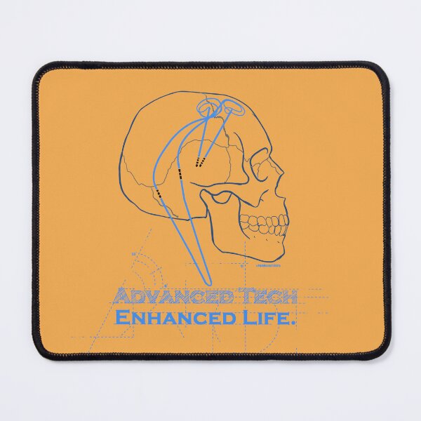 Item preview, Advance Tech Enhanced Life  DBS designed and sold by Steve Parknsons.