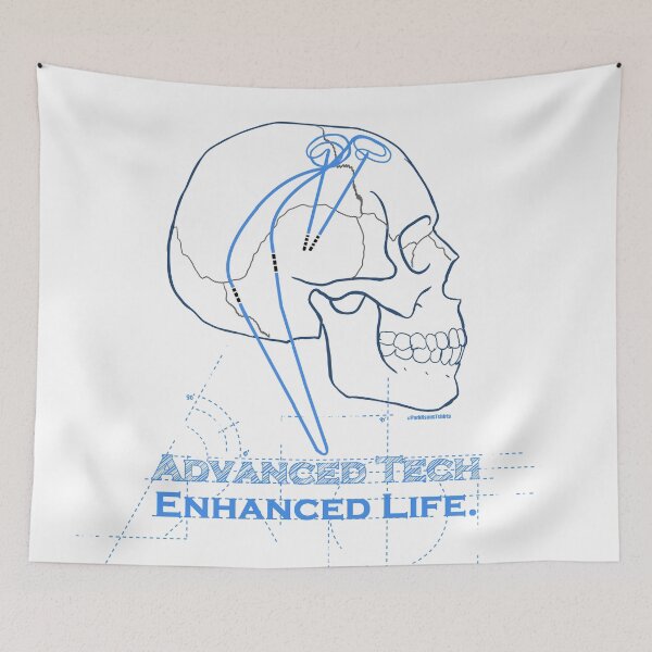 Item preview, Advance Tech Enhanced Life  DBS designed and sold by Steve Parknsons.