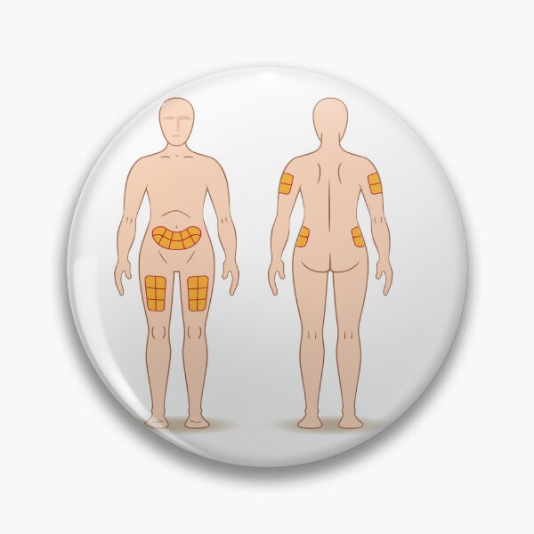 Item preview, Guide for application of a caster injection into a person, back, thigh, shoulder, belly, and may be for the treatment of diabetes or sclerosis designed and sold by LucianoCosmo.