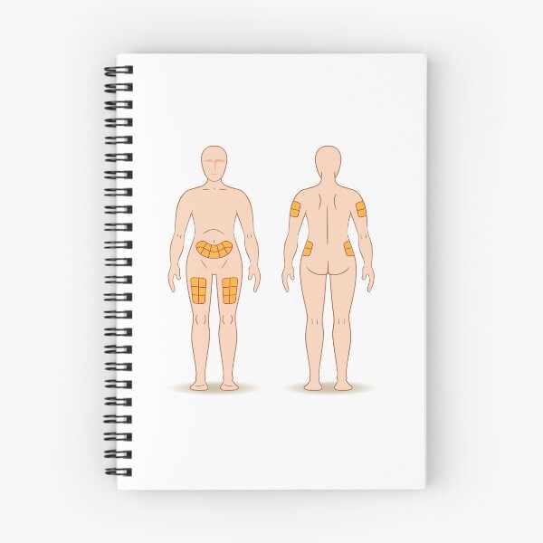 Item preview, Guide for application of a caster injection into a person, back, thigh, shoulder, belly, and may be for the treatment of diabetes or sclerosis designed and sold by LucianoCosmo.